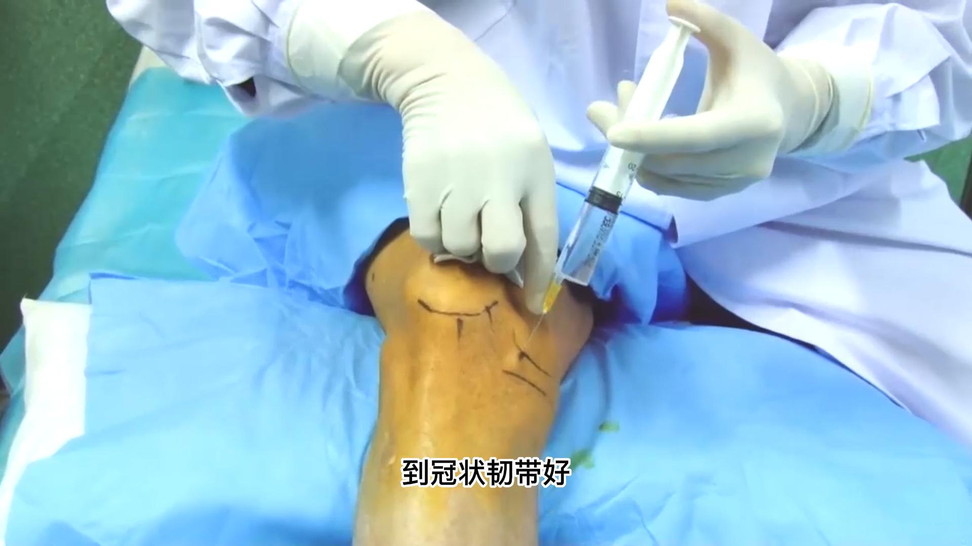 唐国振 膝关节临床操作演示视频封面